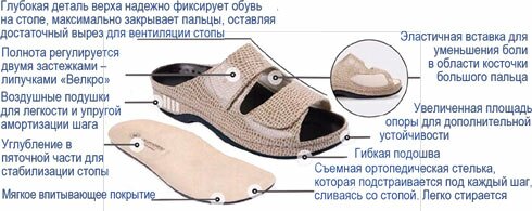 Женская ортопедическая обувь