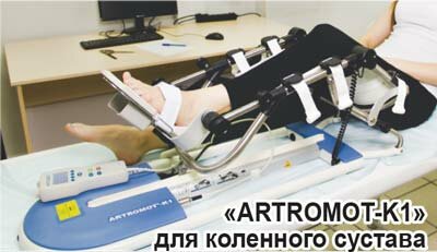 «ARTROMOT-K1» для коленного сустава